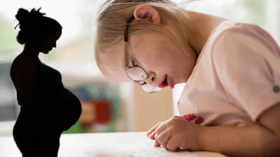 काय आहेत डाउन सिंड्रोमची लक्षणे? प्रेग्नंसीमध्ये या आजाराचे निदान होते का?