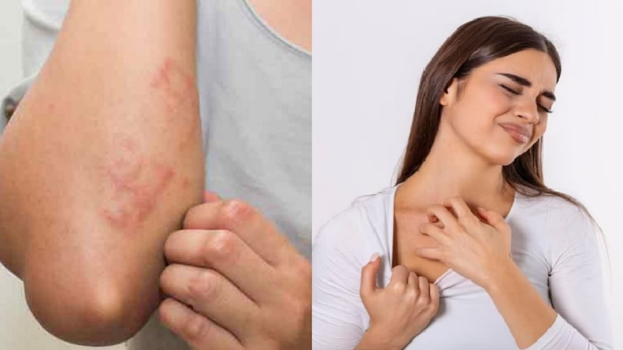 पावसाळ्यात फंगल इंफेक्शन होऊ नये यासाठी स्वत:चे करा असे संरक्षण पावसाळ्यात फंगल इंफेक्शन होऊ नये यासाठी स्वत:चे करा असे संरक्षण