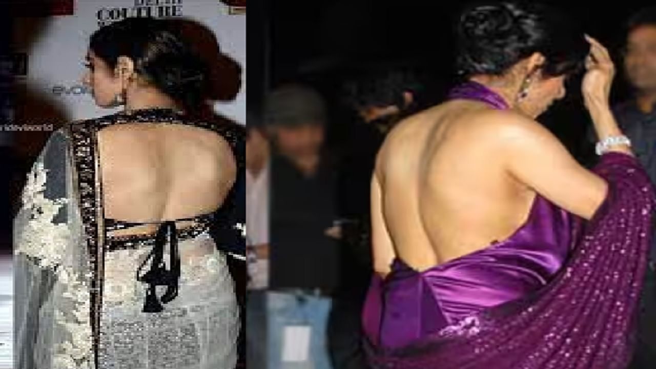 या बॉलिवूड अभिनेत्रीने सुंदर दिसण्यासाठी केल्या 29 सर्जरी; अमिताभ बच्चन ते शाहरूखपर्यंत सर्वच तिचे चाहते