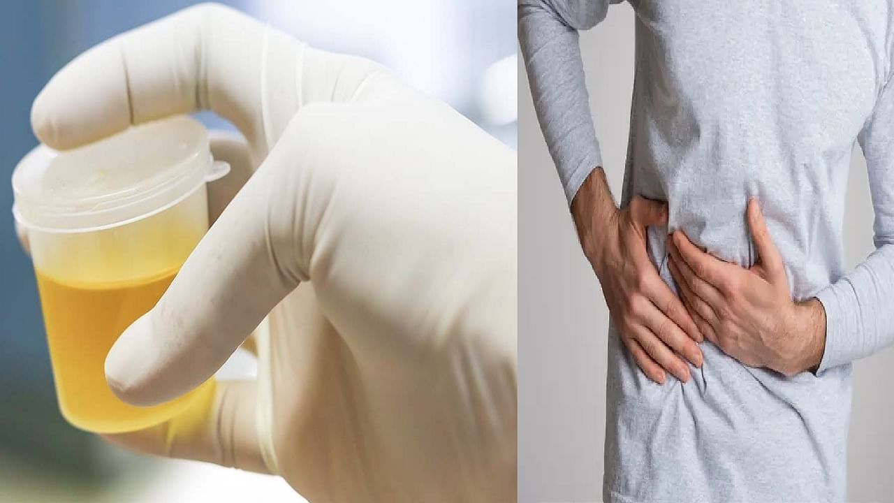 लघवीच्या रंगावरून समजतं की लिव्हर खराब होण्यास सुरुवात झाली हे कसे ओळखावे? लक्षणे कोणती? लघवीच्या रंगावरून समजतं की लिव्हर खराब होण्यास सुरुवात झाली हे कसे ओळखावे? लक्षणे कोणती?