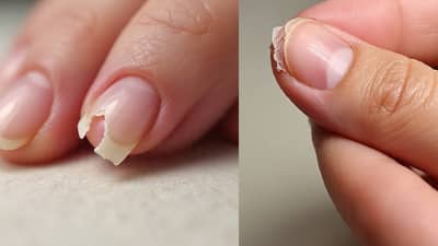 कधी कधी विनाकारण नखे का तुटतात? तज्ञांनी सांगितले मोठी कारणे