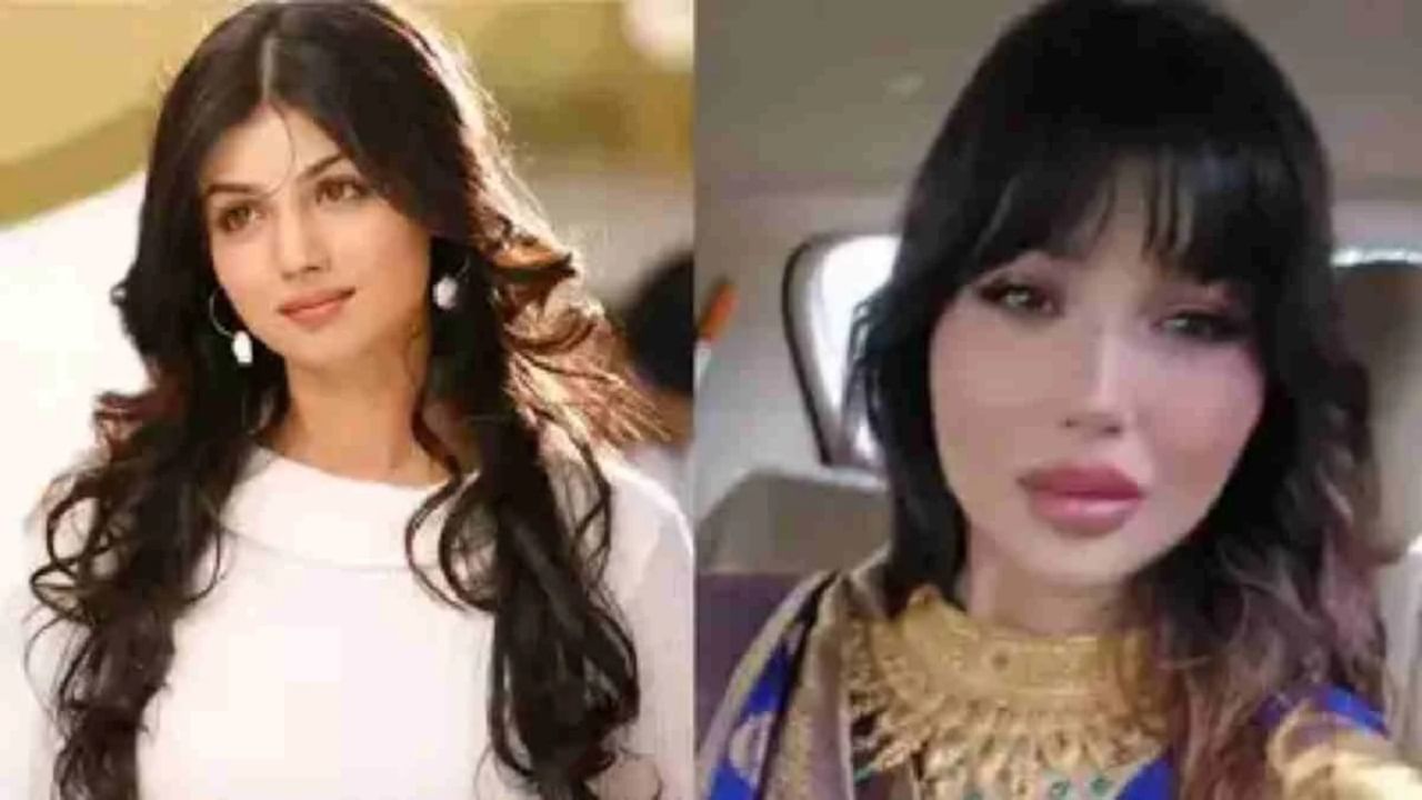 तरुण आणि ग्लॅमरस दिसण्यासाठी अभिनेत्री आयेशा टाकियाने अनेक ब्युटी ट्रीटमेंट्स केल्या आहेत. रिपोर्ट्सनुसार, तिने बोटॉक्स, लिप फिलर्स आणि फेशियल एन्हांसमेंट सारख्या कॉस्मेटिक प्रक्रिया केल्या आहेत. तिच्या लूकमधील बदलांनी चाहत्यांना अनेकदा धक्का दिला आहे.