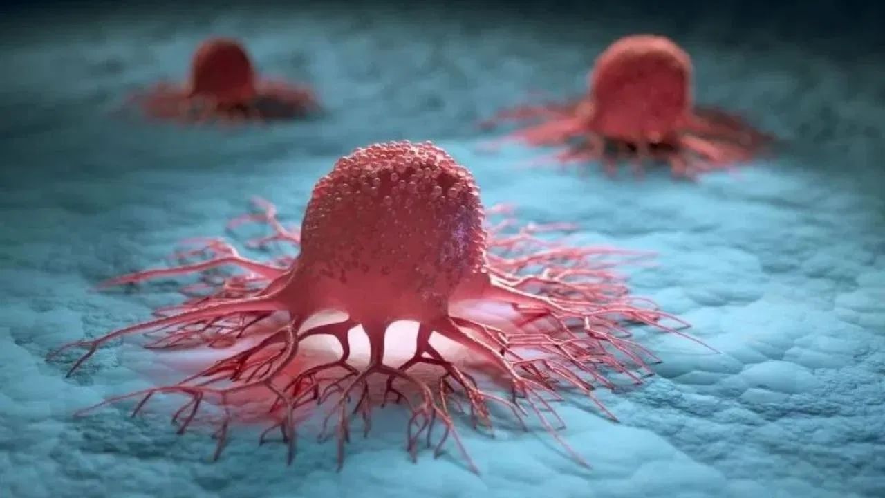 70 वर्षांच्या आजोबांना झाला स्तनांचा कर्करोग, सुरुवातीचे लक्षण काय?