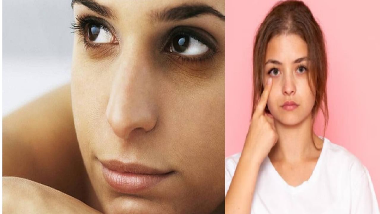 तुम्ही सुद्धा काळ्या वर्तुळांच्या समस्येमुळे त्रस्त आहात? जीवनशैलीमध्ये योग्य बदल करा....