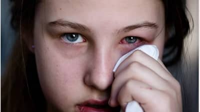 डोळ्यातून पाणी, जळजळ, टोचल्यासारखं होतंय? औषधांशिवाय हे सोपे उपाय देतील आराम!