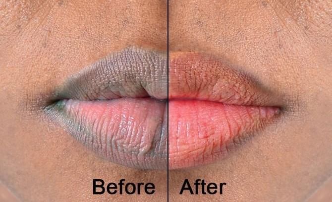 ओठांनाही स्क्रबिंग...तर मऊ आणि गुलाबी ओठ मिळवण्यासाठी 'हे' 3 सोपे घरगुती स्क्रबचा करा वापर