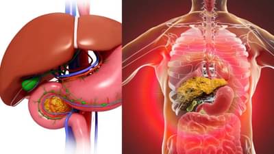किडनी आणि लिव्हर फेल होण्याची लक्षणे आणि कारणे कोणती? जाणून घ्या तज्ज्ञांकडून