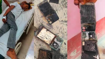 बाईकची कारला धडक झाल्याने, एडमिट झाला तर पॅण्टच्या खिशातच मोबाईलचा ब्लास्ट झाला