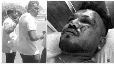 महाभयंकर विमान अपघातातून वाचला, पण रात्रीची झोपच उडाली, बोलणंही बंद, फक्त एकटक... अहमदाबाद दुर्घटनेतील विश्वास कुमार जिवंत असूनही...ती काय?