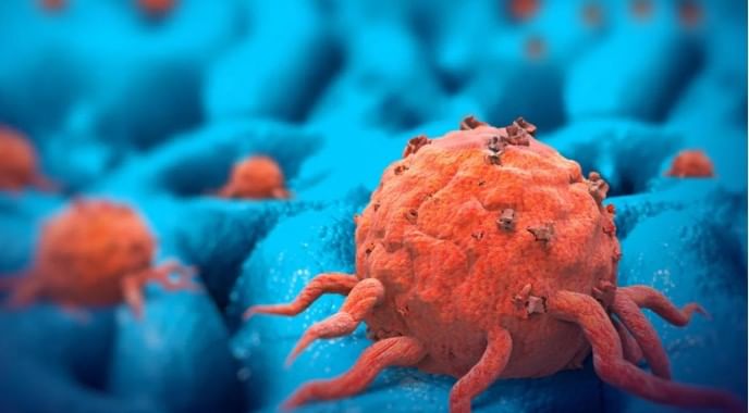 डॉ. तलवार यांच्या सांगण्यांनुसार अनेकजण चिप्स, बिस्किटे, नमकीन, इन्स्टंट नूडल्स, सॉस यासारखे पॅक्ड फूड खातात. अशा प्रकारच्या अन्नात प्रिझर्व्हेटिव्ह्ज, रंग,रसायने मिसळलेले असतात. त्यामुळे अशा पदार्थांचा दीर्घकाळ वापर केला तर ते धोकादायक ठरू शकते. 