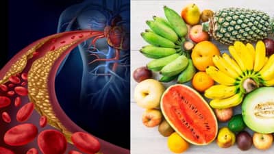 Cholesterol: कोलेस्ट्रॉक नियंत्रणात ठेवण्यासाठी ही स्वस्त मिळणारी फळे नक्की खा, होईल फायदा