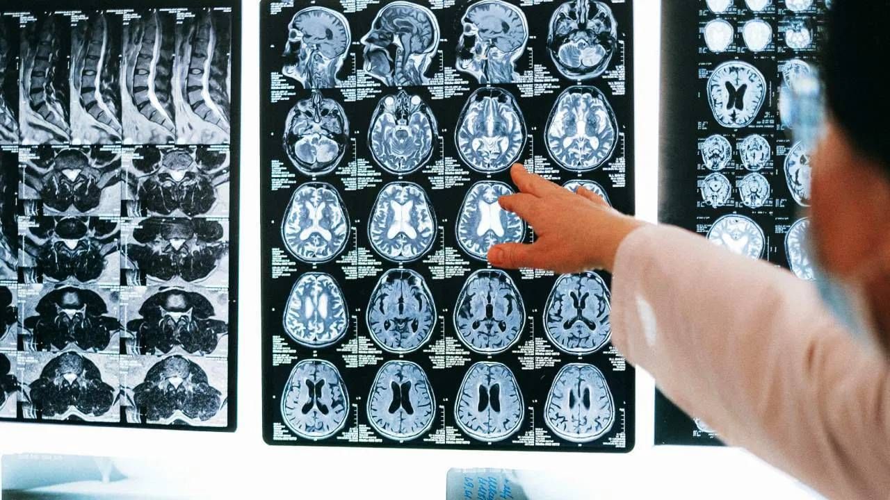 वैज्ञानिक दृष्टीने पाहता मृत्यूनंतर माणसाच्या मेंदूचं मासपेशींवर नियंत्रण संपतं. मग तोंड उघडं किंवा बंद करणं असो किंवा शरीरातील इतर भाग.. या सर्वांवर माणसाचं नियंत्रण संपतं. त्यामुळे फक्त तोंडचं खुलं राहात नाही तर हातपाय देखील सैल पडतात. (Photo: Pixabay/Pexels)