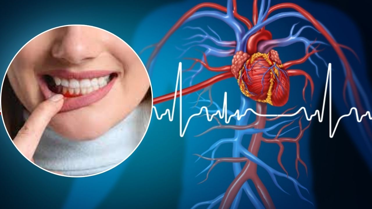 अनेकांना हिरड्यांमधून रक्त येण्याची समस्या असते. कधीकधी ती सामान्य असू शकते, पण कधीकधी ती हृदयविकाराच्या झटक्याचं लक्षण देखील असू शकतं. जर तुम्हाला हिरड्यांमधून सतत रक्त येण्याची समस्या येत असेल तर ताबडतोब त्याकडे लक्ष द्या आणि डॉक्टरांचा सल्ला घेऊन वेळीच उपचार घ्या. 