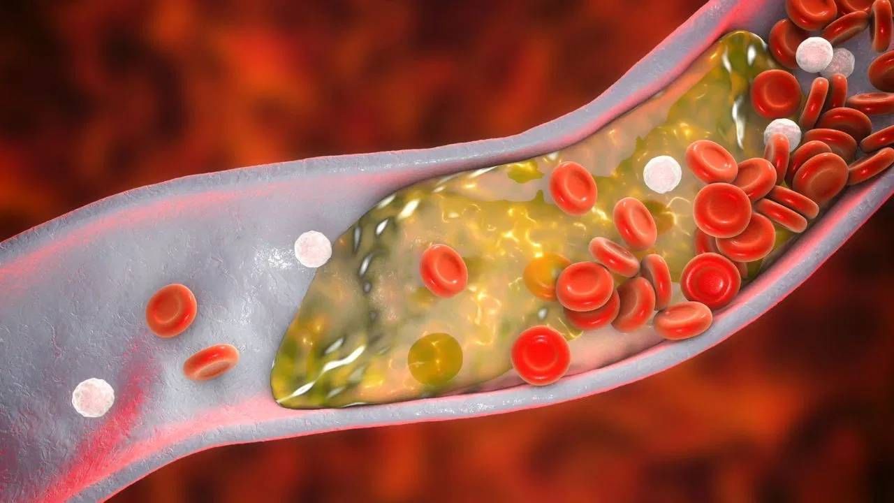 हार्ट ब्लॉकेज झाल्यास सुरुवातीला कोणती लक्षणे दिसतात? दुर्लक्ष करू नका हार्ट ब्लॉकेज झाल्यास सुरुवातीला कोणती लक्षणे दिसतात? दुर्लक्ष करू नका