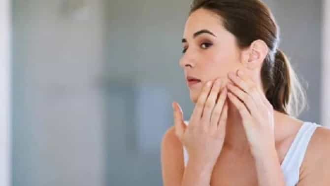 चेहऱ्यावरील काळे डाग कमी करण्यासाठी घरच्या घरी करा हे खास उपाय....