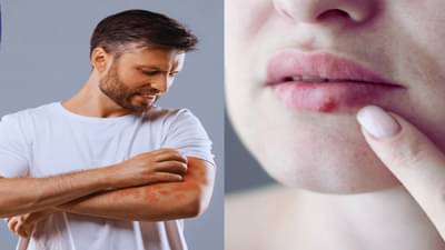 एचआयव्हीची सुरुवातीची लक्षणे कोणती? शरीरात दिसतात हे बदल