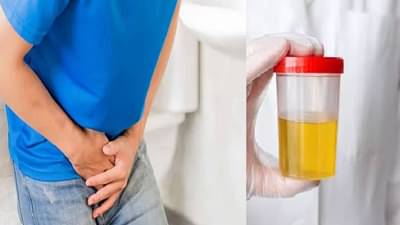 सकाळी उठताच पिवळी लघवी होणे कोणत्या आजाराचे संकेत? तज्ज्ञांकडून जाणून घ्या