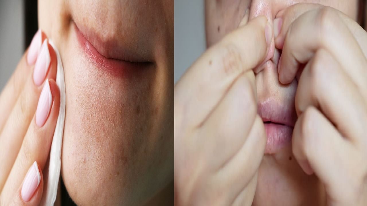 ना स्ट्रिप्सची गरज, ना पार्लरचा खर्च! ब्लॅकहेड्स काढण्यासाठी 'या' 4 टिप्सचा करा वापर