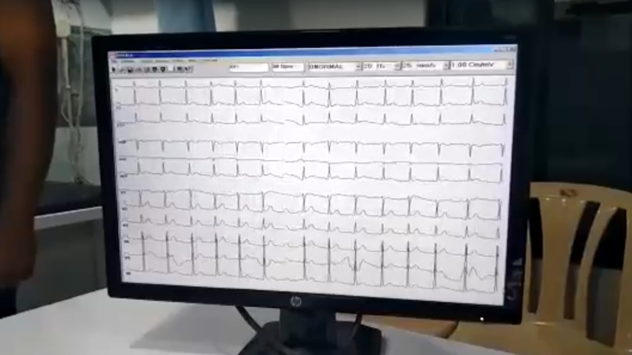 विशेष म्हणजे, हार्ट अटॅकचे निदान करण्यासाठी आवश्यक असलेला 12 LEAD ECG या उपकरणाद्वारे करणे शक्य आहे. या संशोधनाची दखल आंतरराष्ट्रीय स्तरावरही घेण्यात आली आहे.