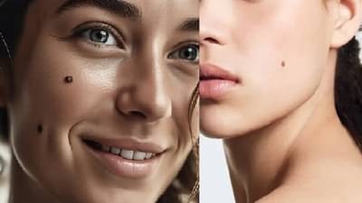 उजव्या गालावर तीळ असणे कशाचे संकेत? तिळाचा व्यक्तिच्या आयुष्यावर कसा होतो परिणाम?