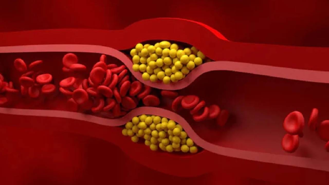 कोलेस्ट्रॉलपेक्षाही भयंकर 'ही' गोष्ट; वाढू शकतो हृदयविकाराचा धोका, काय करू शकता उपाय?