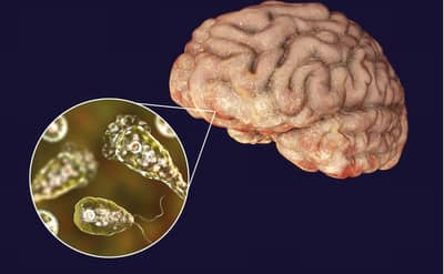 धक्कादायक, मेंदू खाणाऱ्या अमिबामुळे चिमुरडीचा मृत्यू, इतका का धोकादायक असतो हा अमिबा ?