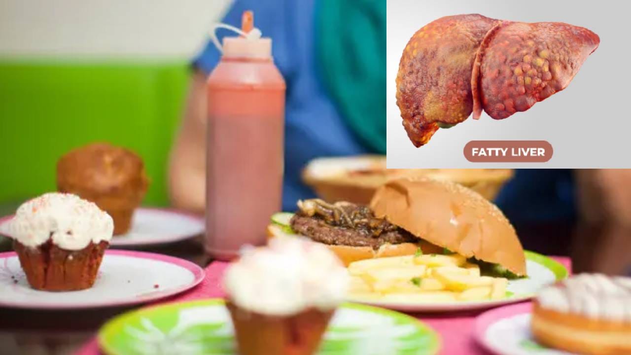 गोड खाल्ल्यामुळे खरंच फॅटी लिव्हरच्या समस्या उद्भवतात का?