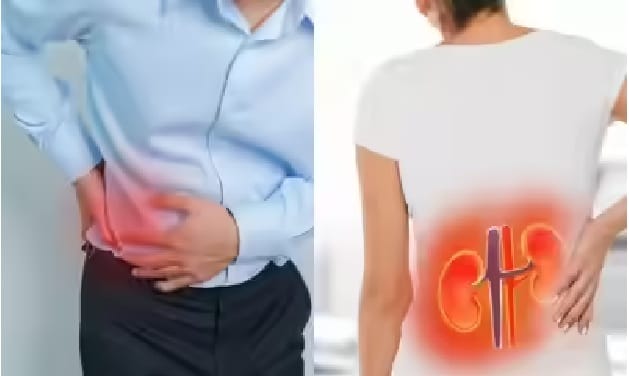 पुरुषांपेक्षा भिन्न असतात महिलांच्या किडनी स्टोनची लक्षणं ? प्रत्येक बाब जाणून घ्या
