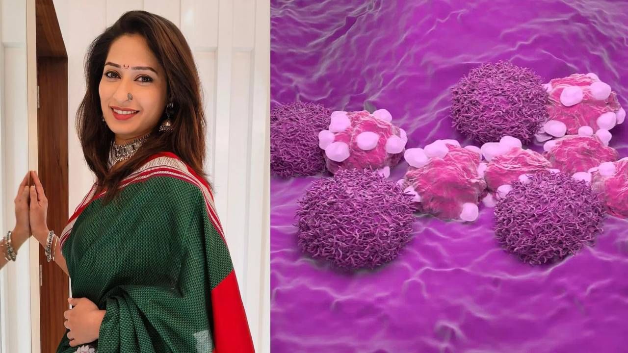 Priya Marathe Death: प्रियाचा अवघ्या 38व्या वर्षी मृत्यू, अगदी कमी वयात कर्करोग का होतो? काय आहेत लक्षणे?