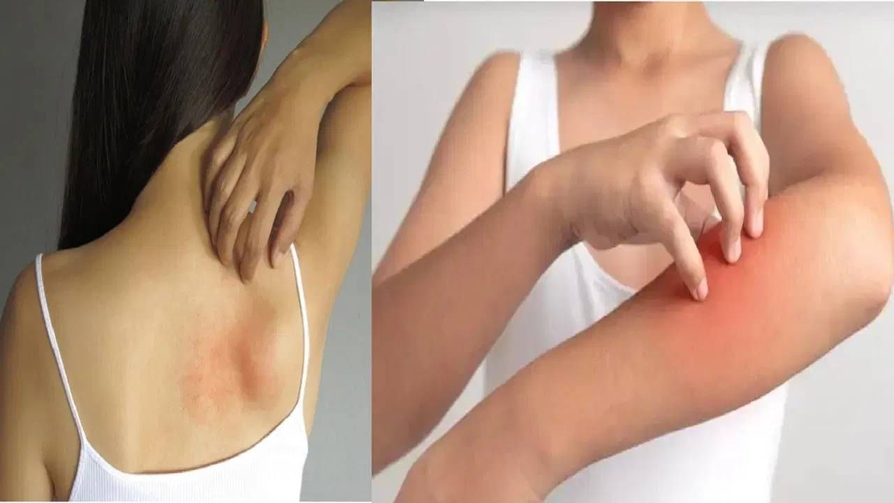  निरोगी शरीरासाठी व्हिटॅमिन डी अत्यंत आवश्यक असते. 'व्हिटॅमिन डी' शरीरात कमी झाले तर अनेक समस्या या निर्माण होऊ शकतात. व्हिटॅमिन डी शरीरातून कमी झाल्यावर आपले शरीर काही संकेत देते. 