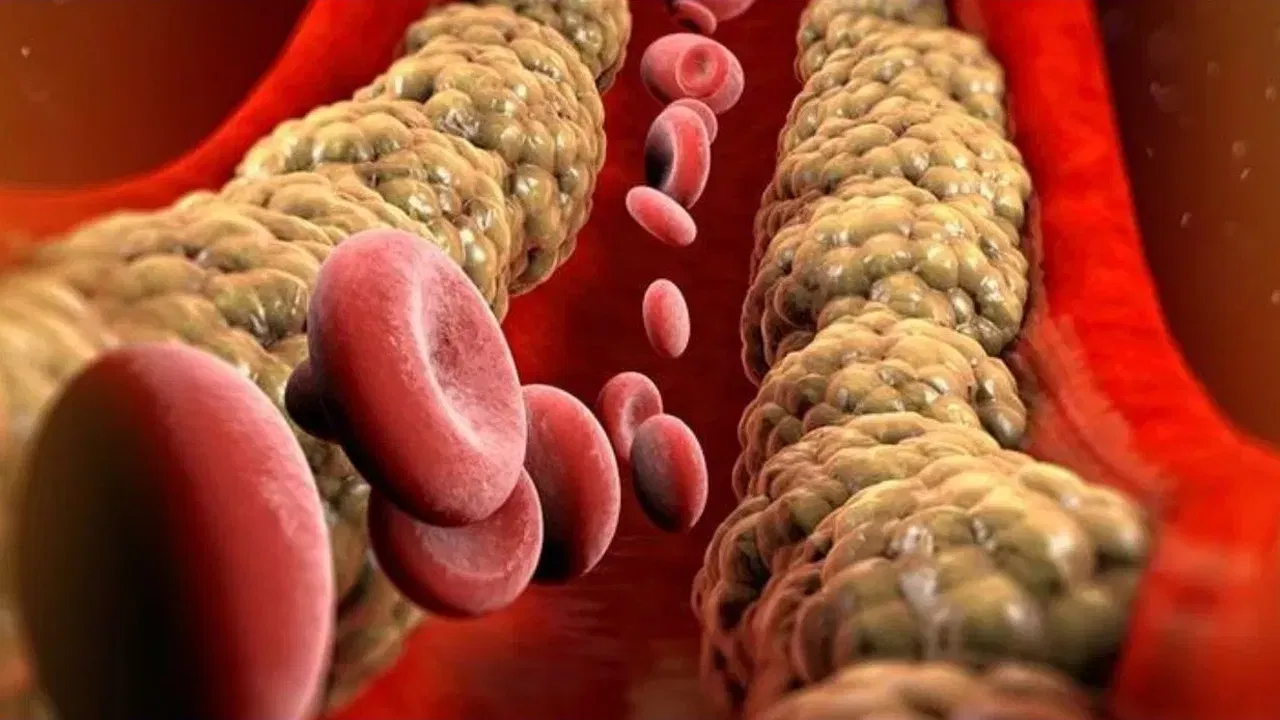 रक्तवाहिन्यांचे संरक्षण: कोलेस्ट्रॉलमुळे रक्तवाहिन्यांमध्ये चरबी साचते, ज्यामुळे त्या अरुंद किंवा बंद होऊ शकतात. नाचणीतील फायबर हे साचलेले कोलेस्ट्रॉल हटवण्यास मदत करते, ज्यामुळे रक्तवाहिन्या स्वच्छ आणि मोकळ्या राहतात.