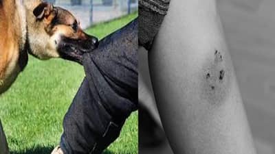 आधीचे 20 मिनिटे महत्वाचे, कुत्रा चावताच हे करा, नाहीतर… 99 टक्के लोकांना काहीच माहीत नाही