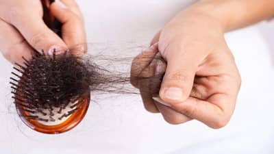 सतत शॅम्पो बदलून आलाय कंटाळा? केस गळण्यामागचं खरं कारण घ्या जाणून