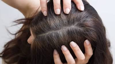 कमी वयात केस पांढरे होत आहेत? सोप्या पद्धतीनं ट्राय करा हे Home Remedies