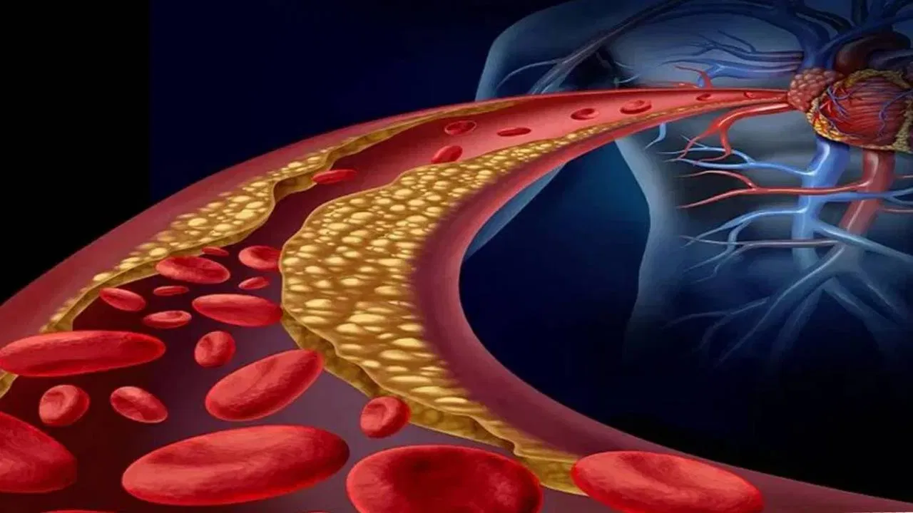 नियंत्रित ग्लायसेमिक इंडेक्स: नाचणीचा ग्लायसेमिक इंडेक्स कमी असल्याने ती खाल्ल्यावर रक्तातील साखरेची पातळी अचानक वाढत नाही. यामुळे मधुमेह आणि हृदयरोग असलेल्यांसाठी नाचणी विशेष फायदेशीर आहे.