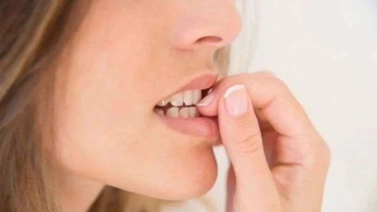 nail biting 3