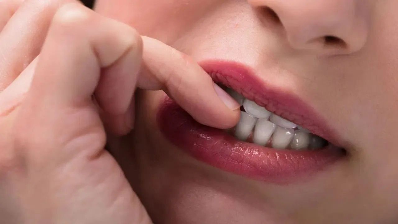 nail biting 4