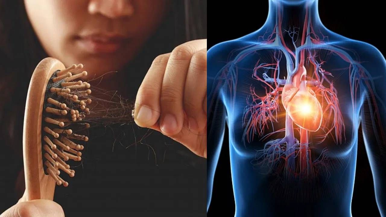 बरेच लोक अचानक टक्कल पडण्याने त्रस्त असतात आणि याला फक्त सौंदर्याची समस्या समजून दुर्लक्ष करतात. पण तुम्हाला माहित आहे का की अचानक टक्कल पडणे तुमच्या हृदयाच्या आरोग्याशी (Heart Health) संबंधित असू शकते? डॉक्टरांचे म्हणणे आहे की केस गळणे आणि हृदयविकाराचा झटका (Heart Attack) यांच्यातील संबंध खूप खोल आहे.