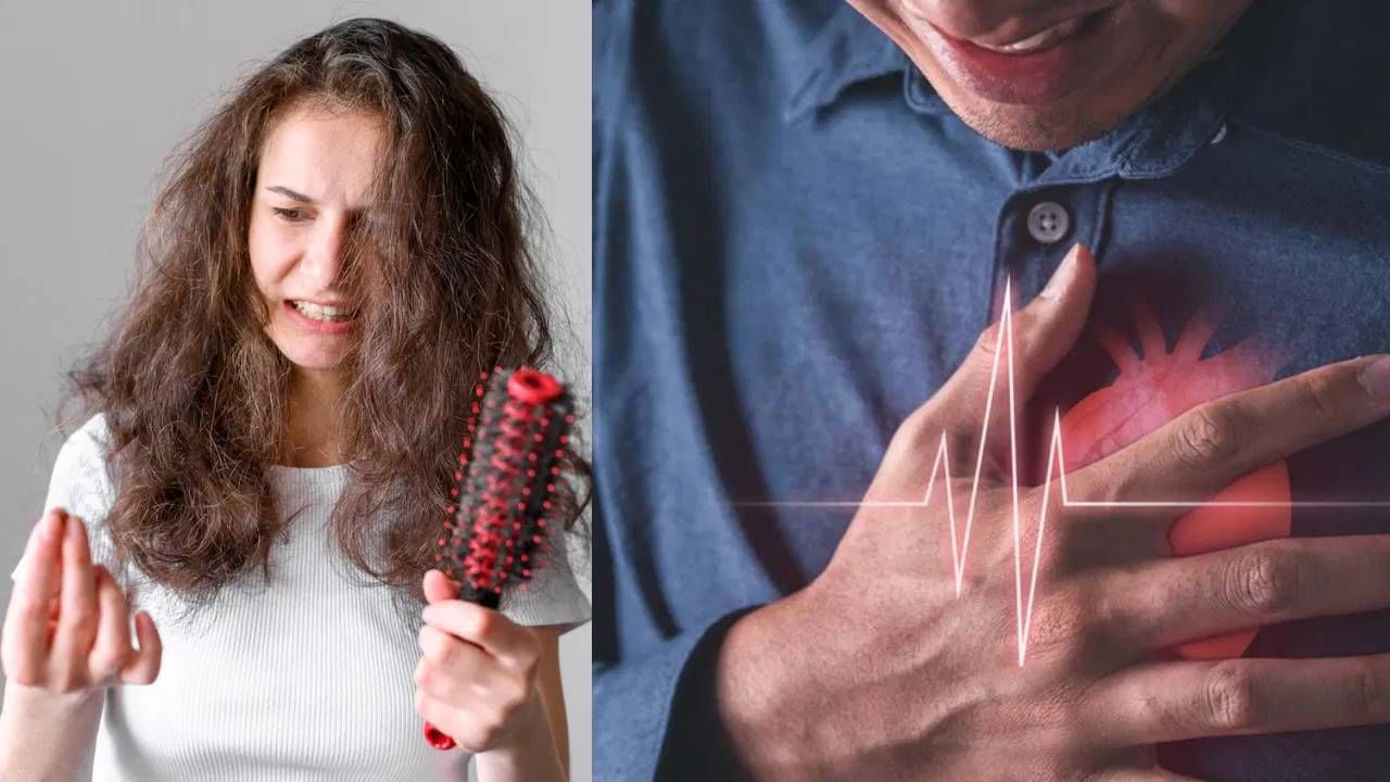 डॉक्टरांच्या म्हणण्यानुसार, केसांचे वेगाने गळणे हे फक्त हार्मोनल असंतुलन (Hormonal Imbalance) किंवा अनुवांशिक कारणांमुळे (Genetics) होत नाही. संशोधनात असे आढळले आहे की टक्कल पडणे आणि हृदयविकाराचा धोका (Baldness and Heart Attack Risk) यांचा एकमेकांशी संबंध आहे. ज्या लोकांना अचानक केस गळणे किंवा टक्कल पडण्याची समस्या उद्भवते, त्यांच्यात हृदयाशी संबंधित आजारांचा धोका वाढतो.