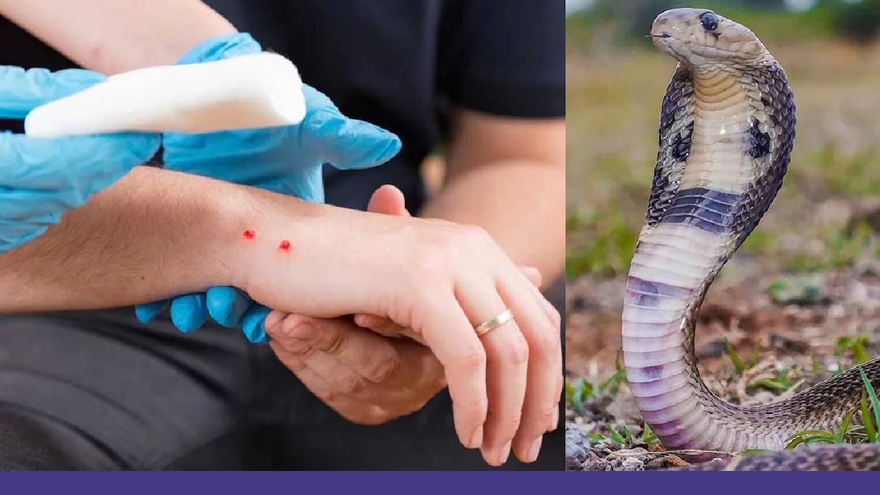 Snake Bite Tips : सापाचा दंश होताच अगोदर करा हे काम, घरीच वाचेल प्राण! डॉक्टरांचा रामबाण उपाय काय?