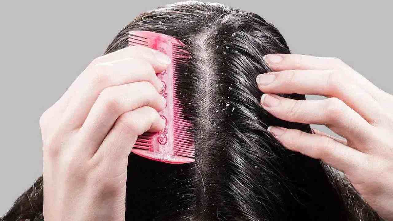 ‘या’ 3 घरगुती उपायांमुळे कोरड्या स्कॅल्पपासून मिळेल मुक्ती, काही दिवसांतच दिसेल फरक