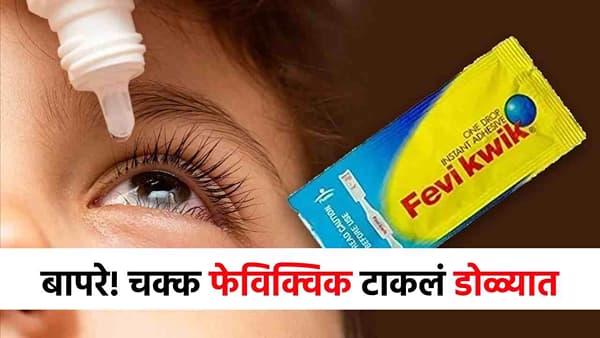 रात्रीच्या अंधारात डोळ्यात टाकलं फेविक्विक, 8 विद्यार्थ्यांची जीवाच्या आकांताने तडफड; शाळेत खळबळ!