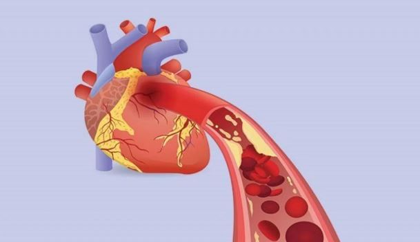 शरीरात रक्ताचा प्रवाह सुरळीत होत नसेल तर त्वचेच्या रंगात बदल होतो. विशेषत: बोटांच्या त्वचेचा रंग बदलतो. बोट निळे, जांभळे दिसायला लागतात. थंडी, तणाव यामुळेदेखील बोटांच्या त्वचेच्या रंगात बदल होऊ शकतो. मात्र हे लक्षण पुन्हा-पुन्हा दिसत असेल तर तुम्हाला पेरिफेरल आर्टरी डिसिज होण्याचा हा संकेत असू शकतो. त्यामुळे लगेच डॉक्टरांचा सल्ला घ्या