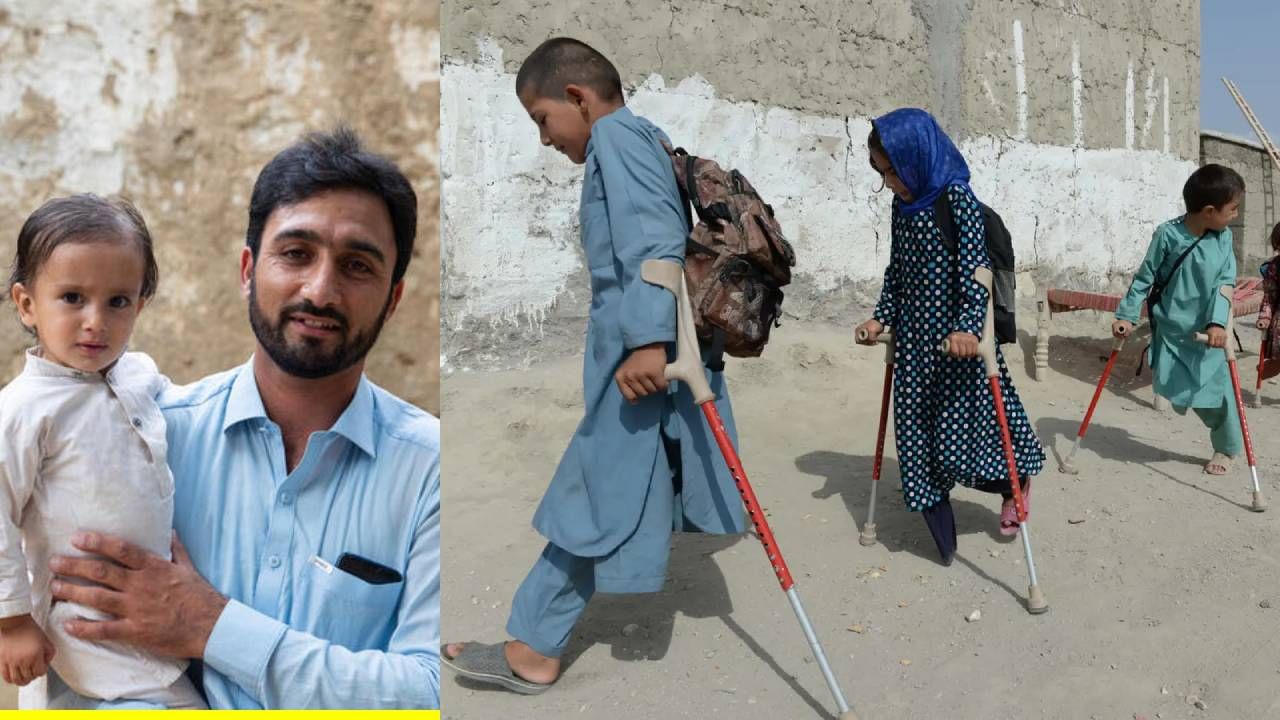 ‘हे’ दोन देश अजूनही मुलांना अपंग करणाऱ्या ‘या’ आजाराशी झुंज देत आहे, जाणून घ्या ‘हे’ दोन देश अजूनही मुलांना अपंग करणाऱ्या ‘या’ आजाराशी झुंज देत आहे, जाणून घ्या