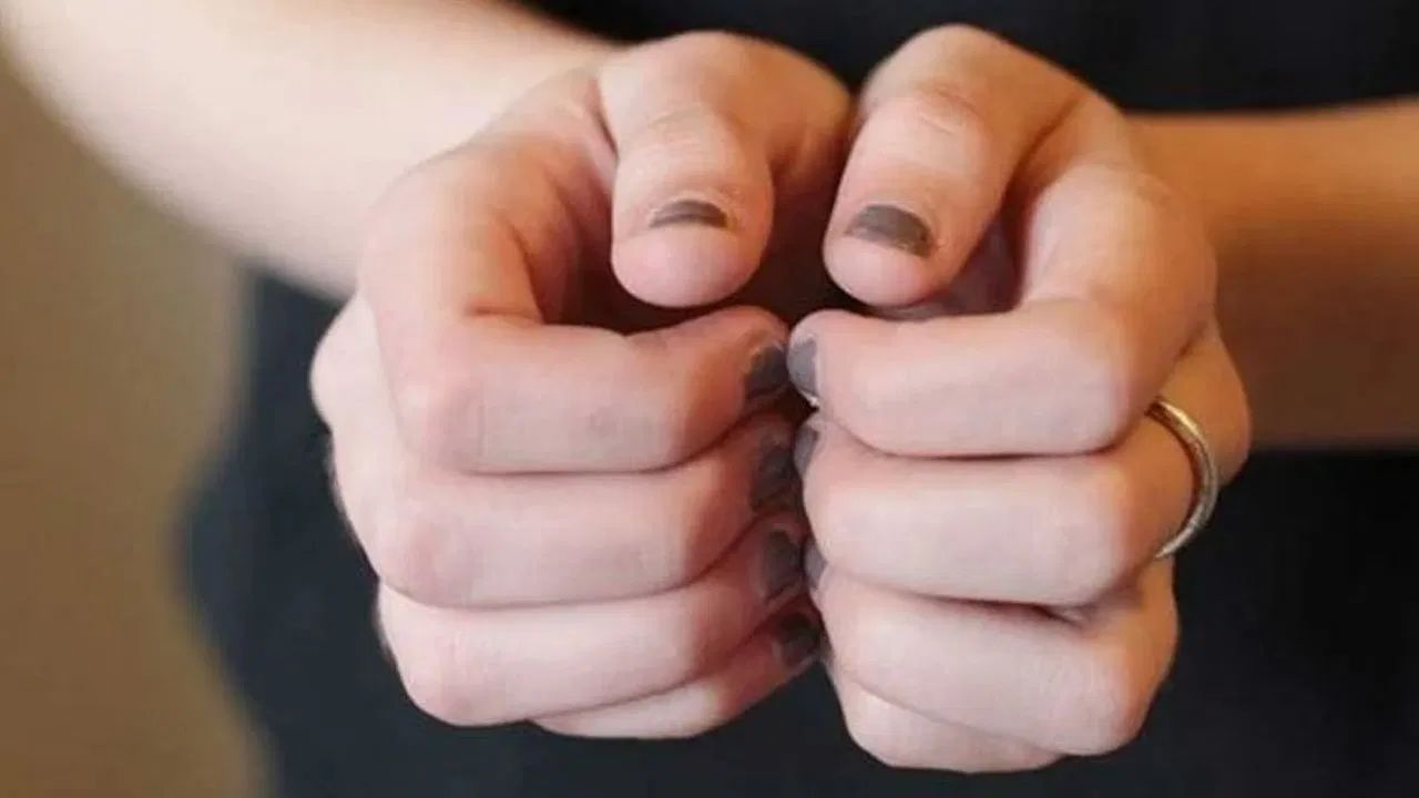 तुम्ही डॉक्टरांचा सल्ला घेतल्यानंतर व्हिटॅमिन बी १२ च्या गोळ्या देखील घेऊ शकता. मात्र कोणताही आहार बदल किंवा सप्लिमेंट्स सुरू करण्यापूर्वी डॉक्टरांचा सल्ला  आठवणीने घ्या.