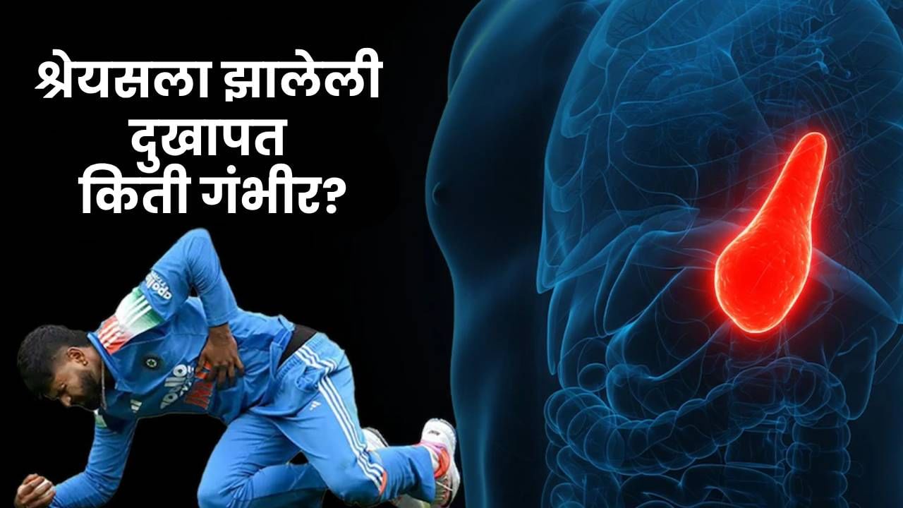 श्रेयस अय्यरची दुखापत किती गंभीर? डिस्चार्जनंतरही घ्यावी लागेल या गोष्टींची काळजी श्रेयस अय्यरची दुखापत किती गंभीर? डिस्चार्जनंतरही घ्यावी लागेल या गोष्टींची काळजी