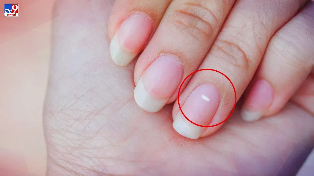 White Spots on Nails: नखांवरील पांढऱ्या डागांचे नशीबाशी आहे खास कनेक्शन, वाचा नेमकं काय? White Spots on Nails: नखांवरील पांढऱ्या डागांचे नशीबाशी आहे खास कनेक्शन, वाचा नेमकं काय?