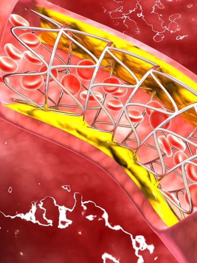 हिवाळ्यात कोलेस्टेरॉल नियंत्रित करण्यासाठी हे पदार्थ खा