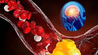 Cholesterol: शरीराच्या या भागांमधील दुखणे असू शकतात कोलेस्ट्रॉल वाढण्याचे संकेत, त्वरीत डॉक्टरांना दाखवा