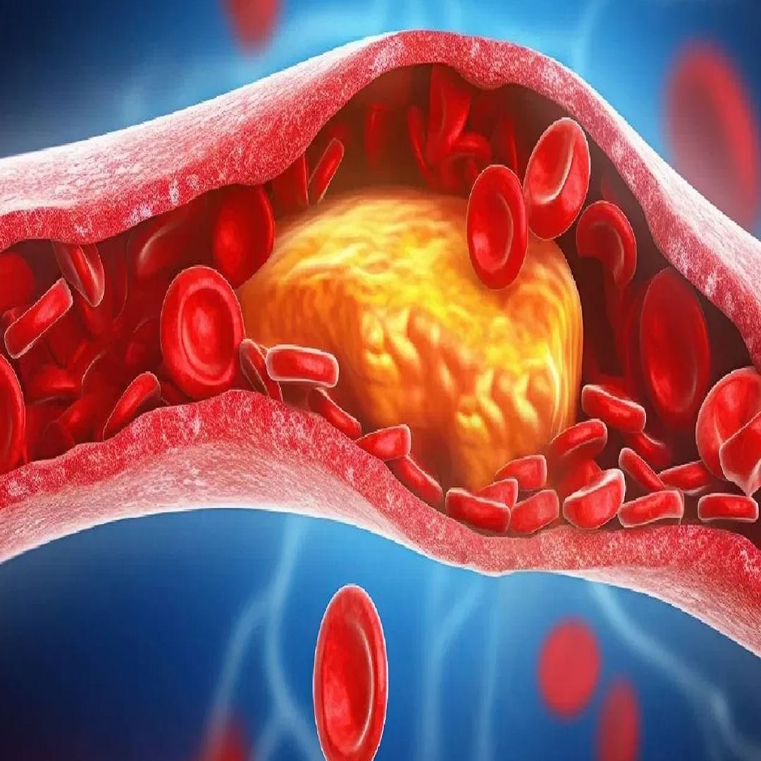  पेरूमधील पोटॅशियम आणि फायबर हृदयाच्या आरोग्यासाठी चांगले असतात. ते रक्तदाब आणि खराब कोलेस्ट्रॉल नियंत्रित करण्यास मदत करू शकते, ज्यामुळे हृदयरोगाचा धोका कमी होतो.